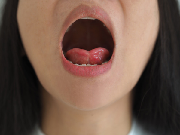 closeup of woman with tongue tie 
